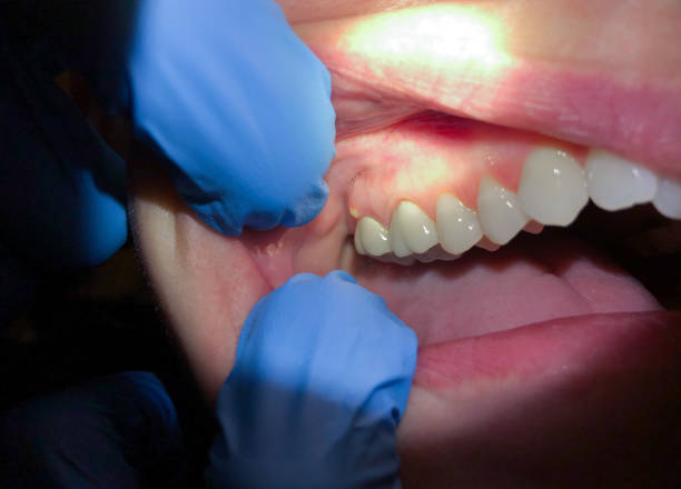 Best Emergency Dental Services for Seniors in Munsons Corners, NY