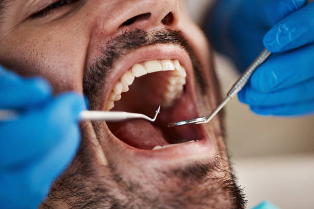Best Pediatric Emergency Dentist in Munsons Corners, NY